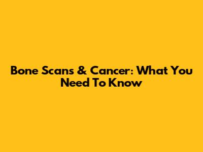 Bone Scans & Cancer: What You Need To Know