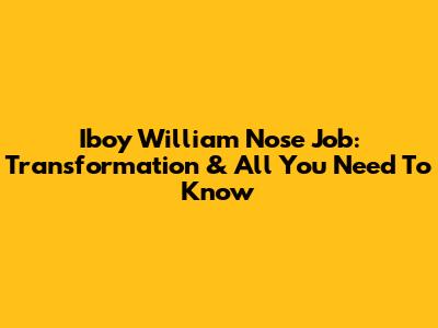 Iboy William Nose Job: Transformation & All You Need To Know
