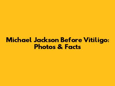 Michael Jackson Before Vitiligo: Photos & Facts
