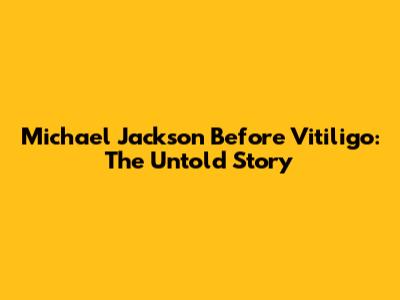 Michael Jackson Before Vitiligo: The Untold Story