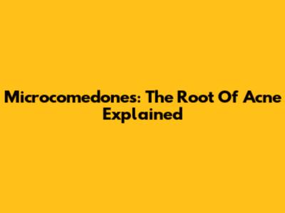 Microcomedones: The Root Of Acne Explained