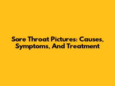 Sore Throat Pictures: Causes, Symptoms, And Treatment